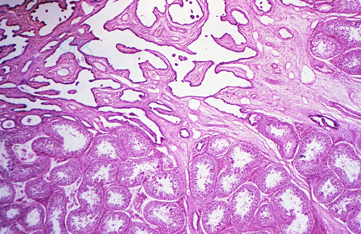 تصویر میکروسکوپی Testis برای آموزش پزشکی