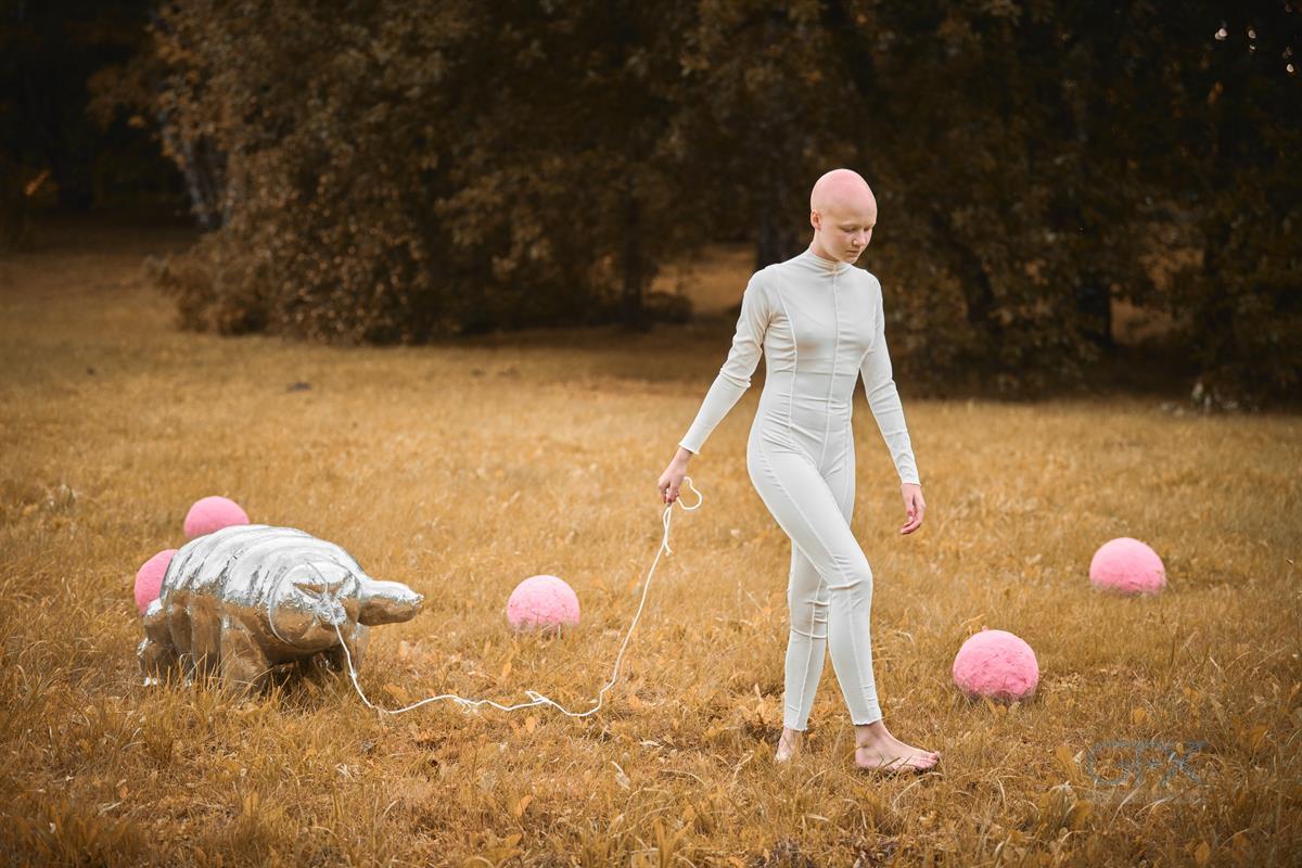 پرتره دختر جوان بدون مو | Young Alopecia Portrait